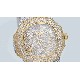 Patek   Philippe (Moissanite) Watch